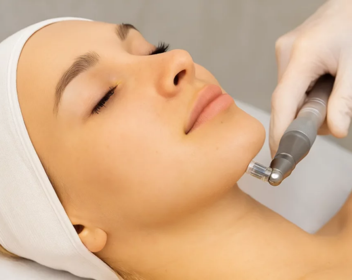 ✨ Мікронідлінг: що це за процедура і кому вона підходить